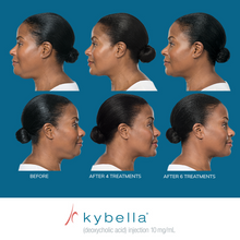 Load image into Gallery viewer, Kybella® Neck Firming Package