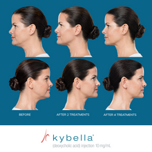 Load image into Gallery viewer, Kybella® Neck Firming Package