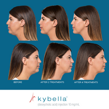 Load image into Gallery viewer, Kybella® Neck Firming Package