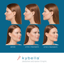 Load image into Gallery viewer, Kybella® Neck Firming Package