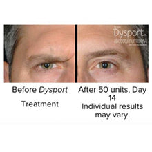 Load image into Gallery viewer, Dysport® For Men
