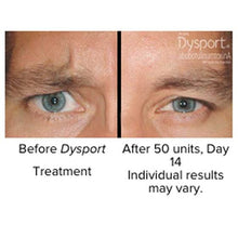 Load image into Gallery viewer, Dysport® For Men
