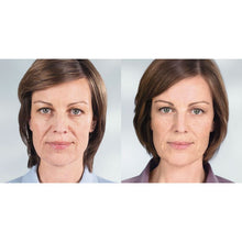 Load image into Gallery viewer, Sculptra® Aesthetic
