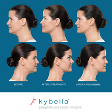 Load image into Gallery viewer, Kybella® Neck Firming Package
