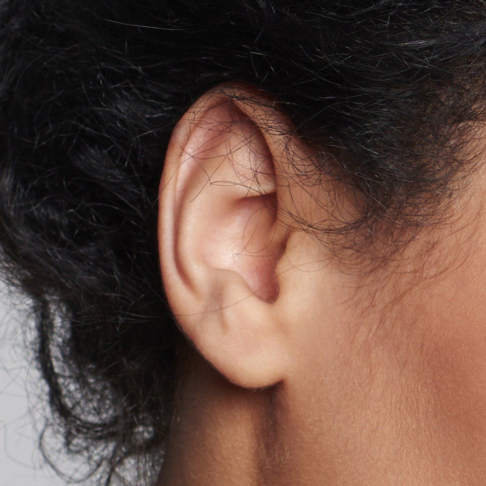 Ear Pinning (Otoplasty)