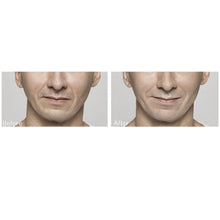 Load image into Gallery viewer, Restylane®
